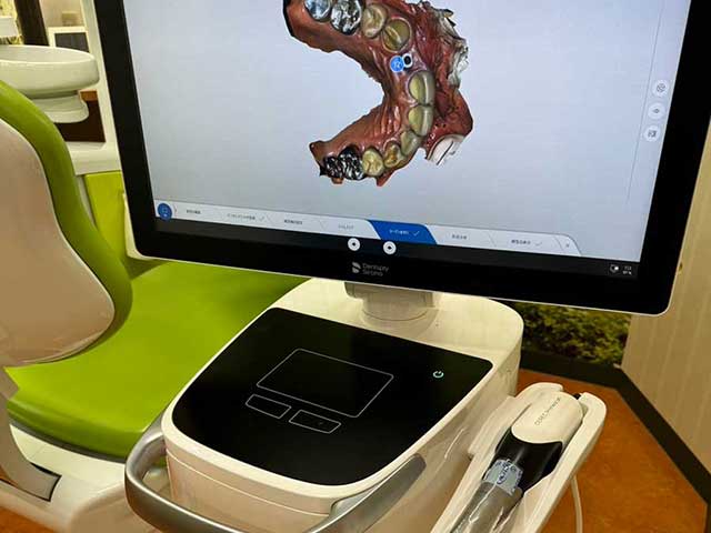 歯科用3Dスキャナー